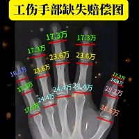 铁公鸡1毛不拔